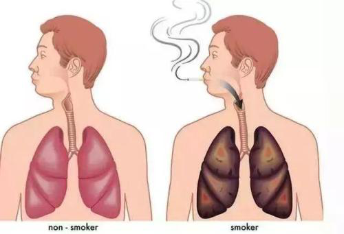 肺功能检查示意图图片